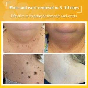 flysmus® Bee Venom All-in-One Cream 11 flysmus® Bee Venom All-in-One Cream