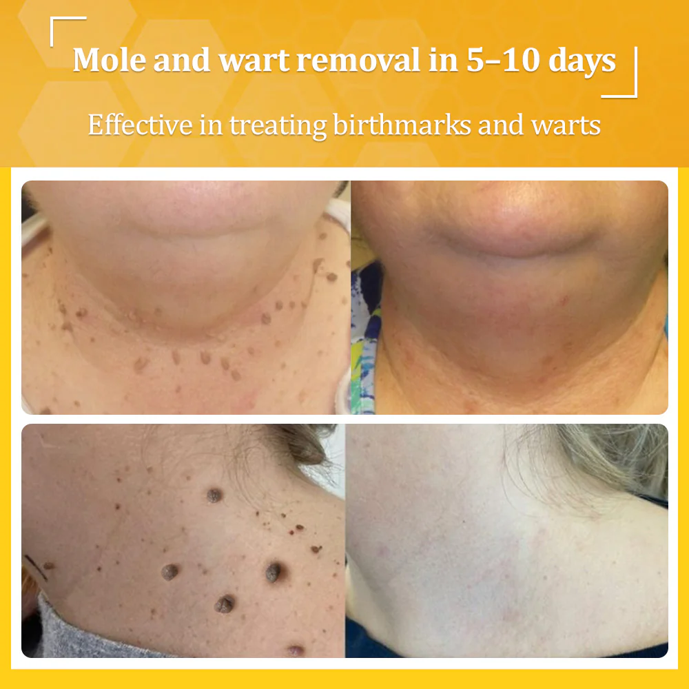 flysmus® Bee Venom All-in-One Cream 3 flysmus® Bee Venom All-in-One Cream