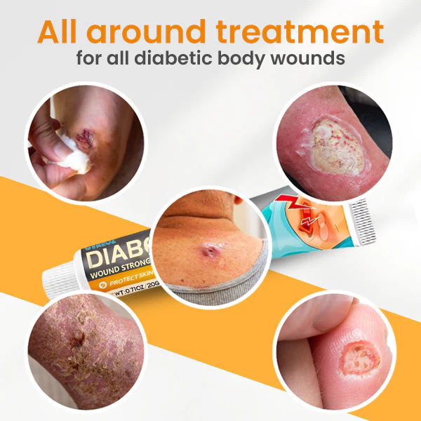 Cvreoz® Diabetes Wound Strong Treatment Cream 5 Cvreoz® Diabetes Wound Strong Treatment Cream - Image 5