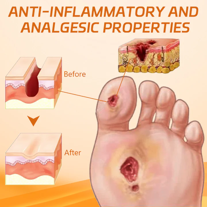 Cvreoz® Diabetes Wound Strong Treatment Cream 7 Cvreoz® Diabetes Wound Strong Treatment Cream - Image 7