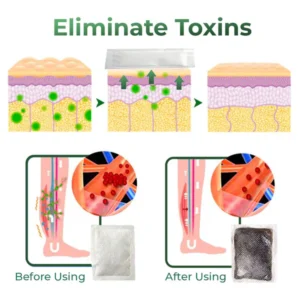 Cvreoz® Varicose Vein Relief Herbal Foot Patch 10 Cvreoz® Varicose Vein Relief Herbal Foot Patch