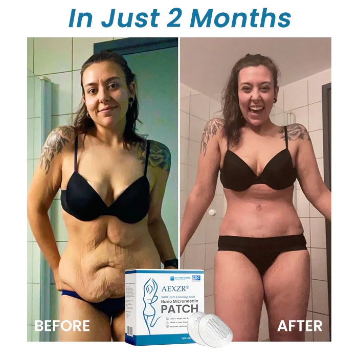 Best Deal AEXZR® SMGT-GLP1 & Matrixyl 3000 Nano Microneedle Patch 9 AEXZR® SMGT-GLP1 & Matrixyl 3000 Nano Microneedle Patch