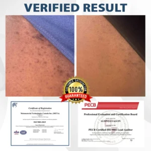 Fivfivgo® ManGuard HPV WART Healing Cream 8 Fivfivgo® ManGuard HPV WART Healing Cream