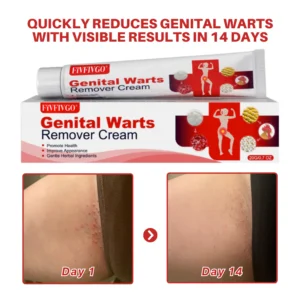 Fivfivgo® FloraGuard HPV Genital Warts Remover Fivfivgo® FloraGuard HPV Genital Warts Remover