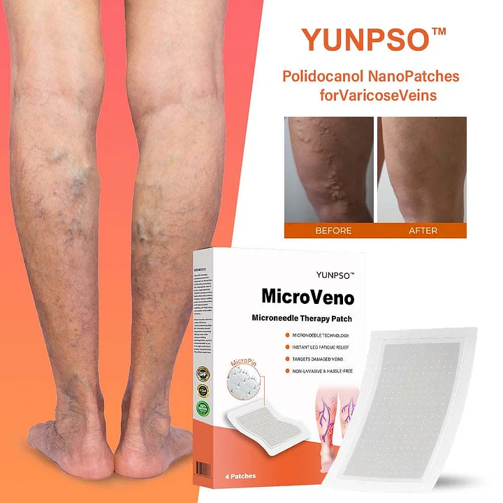 YUNPSO™ MicroVeno Microneedle Terapiya Yaması 10 YUNPSO™ MicroVeno Microneedle Terapiya Yaması