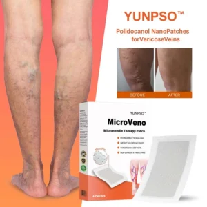 YUNPSO™ MicroVeno Microneedle Terapiya Yaması 15 YUNPSO™ MicroVeno Microneedle Terapiya Yaması