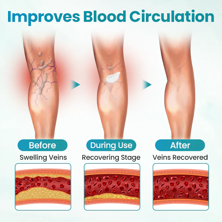 Fivfivgo® VeinEase Soothing Cream 3 Fivfivgo® VeinEase Soothing Cream