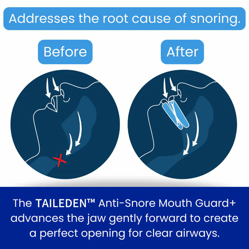 TAILEDEN™ Anti-Snore Mouth Guard 3 TAILEDEN™ Anti-Snore Mouth Guard