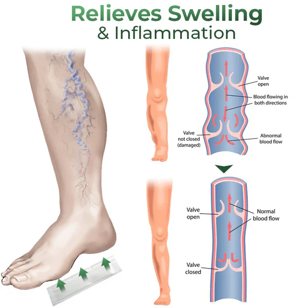 Cvreoz® Varicose Vein Relief Herbal Foot Patch 5 Cvreoz® Varicose Vein Relief Herbal Foot Patch - Image 5