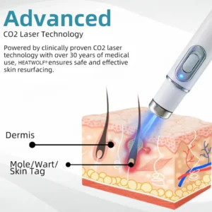 Cougex® Non-invasive Mole & Wart Removal Laser Pen
