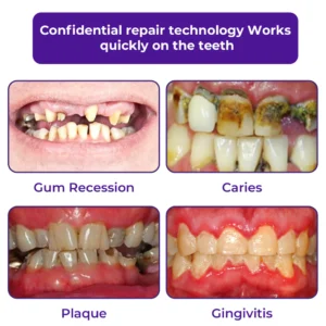 Dobshow™ Dental Repair Mineral Powder 9 Dobshow™ Dental Repair Mineral Powder