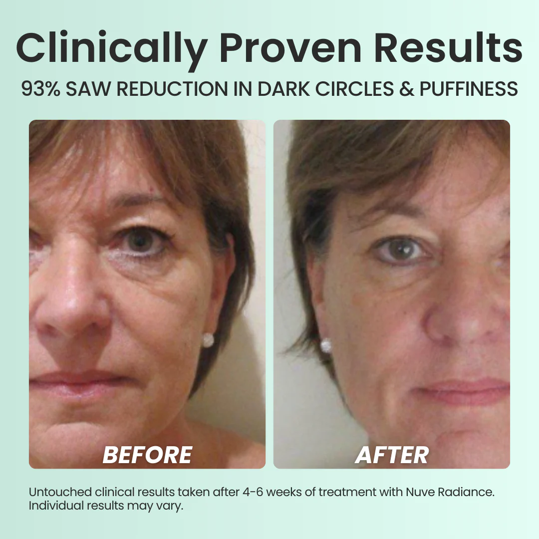 Nuve Radiance 5 Nuve Radiance