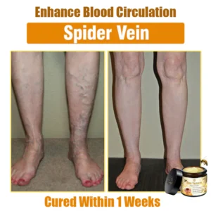 Oveallgo™ Bee Venom Skin Treatment Cream 16 Oveallgo™ Bee Venom Skin Treatment Cream