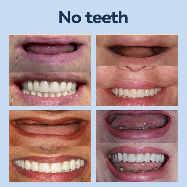 YUNPSO™– Premium Adaptive Dentures 8 YUNPSO™– Premium Adaptive Dentures