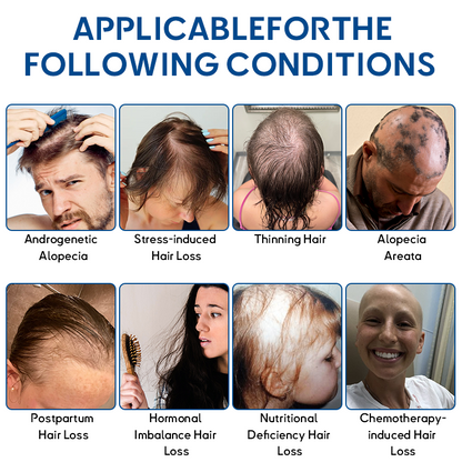 KUBOZN® STEM Cell Hair Cycle Roller 5 KUBOZN® STEM Cell Hair Cycle Roller - Image 5