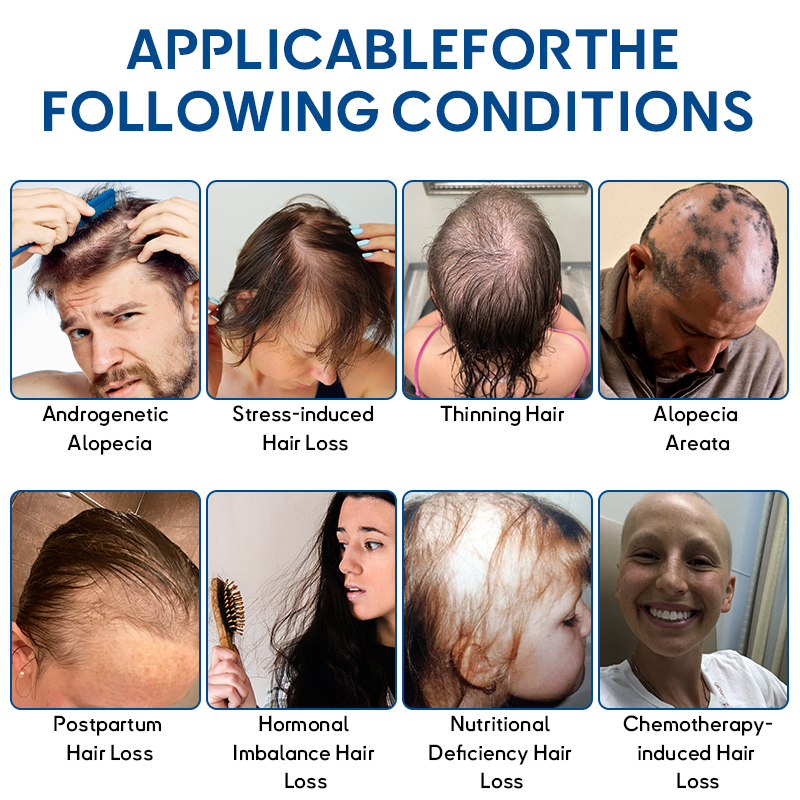 KUBOZN® STEM Cell Hair Cycle Roller 2 KUBOZN® STEM Cell Hair Cycle Roller