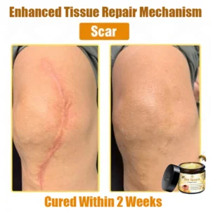 Oveallgo™ Bee Venom Skin Treatment Cream 20 Oveallgo™ Bee Venom Skin Treatment Cream