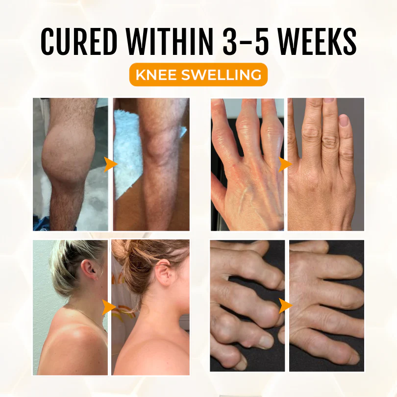 ArthriGone Magnesium Oil & Bee Venom Joint Care Spray 5 ArthriGone Magnesium Oil & Bee Venom Joint Care Spray