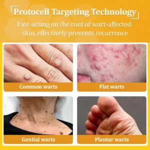 flysmus® Bee Venom All-in-One Cream 13 flysmus® Bee Venom All-in-One Cream