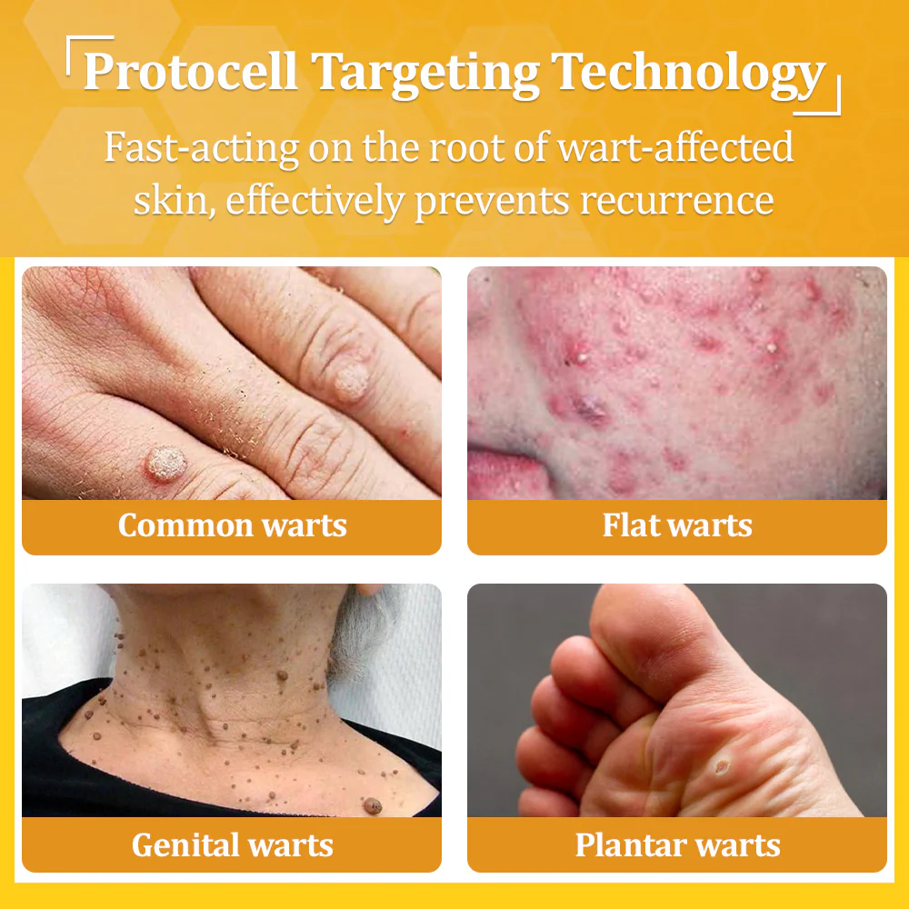 flysmus® Bee Venom All-in-One Cream 5 flysmus® Bee Venom All-in-One Cream - Image 5