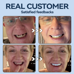 YUNPSO™– Premium Adaptive Dentures 23 YUNPSO™– Premium Adaptive Dentures