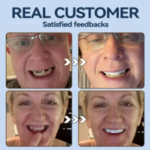 SmileFitPro® – MedicalFit Adaptive Dentures 23 SmileFitPro® – MedicalFit Adaptive Dentures