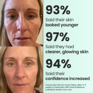 Nuve Radiance 18 Nuve Radiance