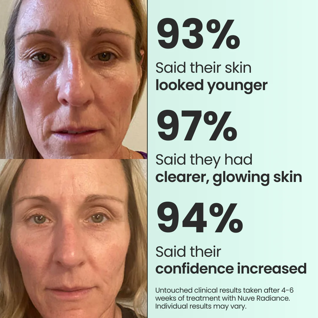 Nuve Radiance 8 Nuve Radiance