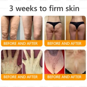 LBMLBM™ Bee venom Comprehensive Cream 11 LBMLBM™ Bee venom Comprehensive Cream