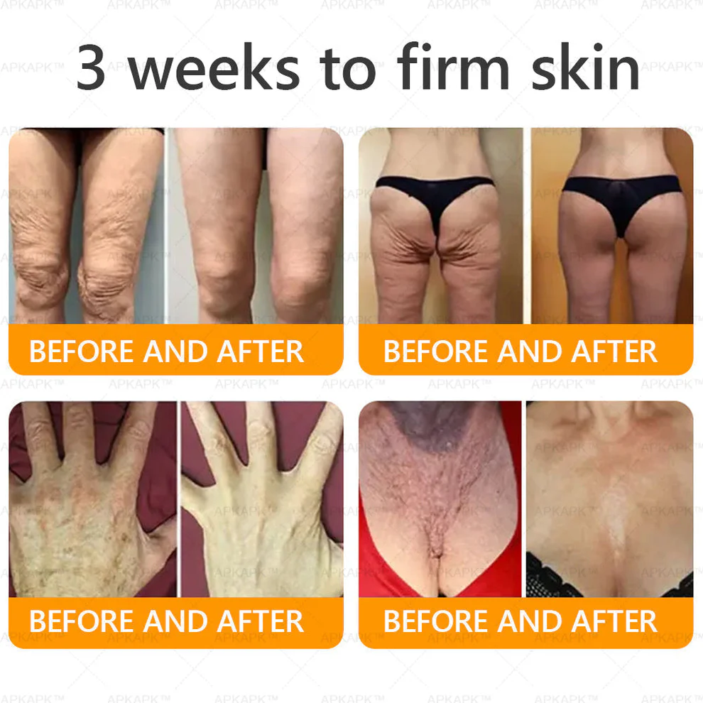 LBMLBM™ Bee venom Comprehensive Cream 3 LBMLBM™ Bee venom Comprehensive Cream