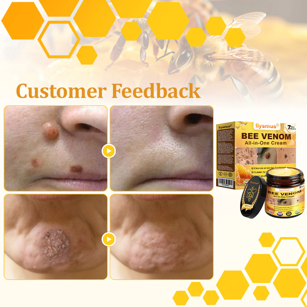 flysmus® Bee Venom All-in-One Cream 7 flysmus® Bee Venom All-in-One Cream - Image 7