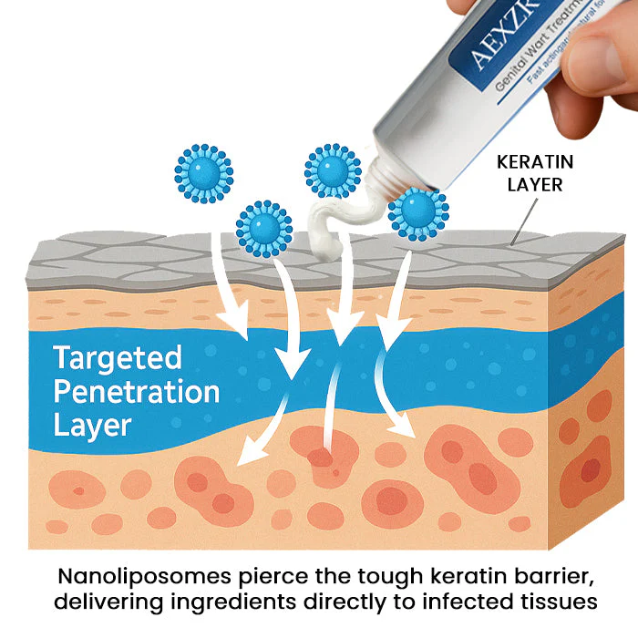 AEXZR® HPV Genital Wart Treatment Cream 5 AEXZR® HPV Genital Wart Treatment Cream