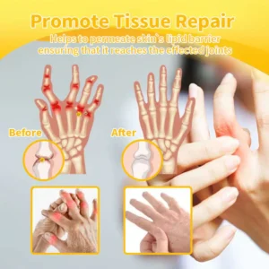 Best Deal flysmus™ Bee-Venom Pain-Relief Bone Healing Cream