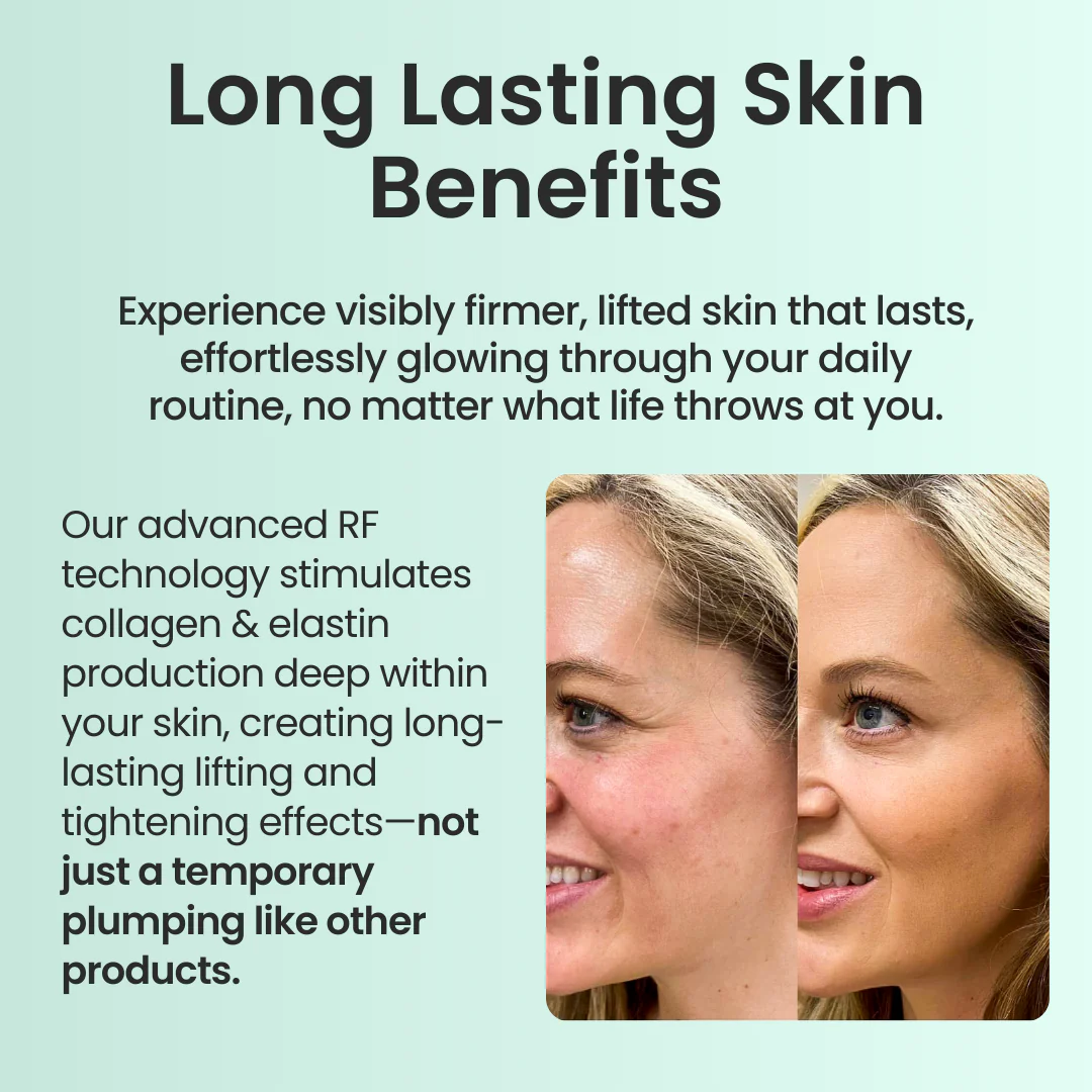 Nuve Radiance 9 Nuve Radiance