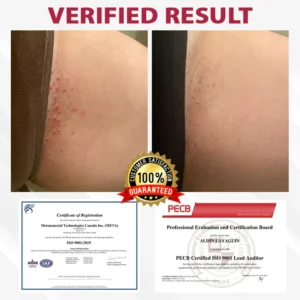 ATTDX® FemGuard Genital HPV Care Spray