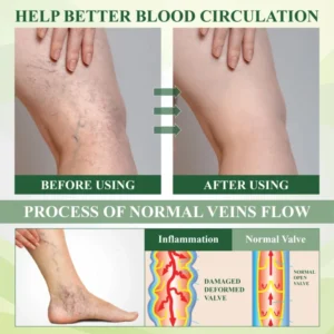 ATTDX® CircuHerb Edema Soothing & Healing Balm