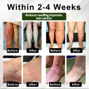 ATTDX® CircuHerb Edema Soothing & Healing Balm
