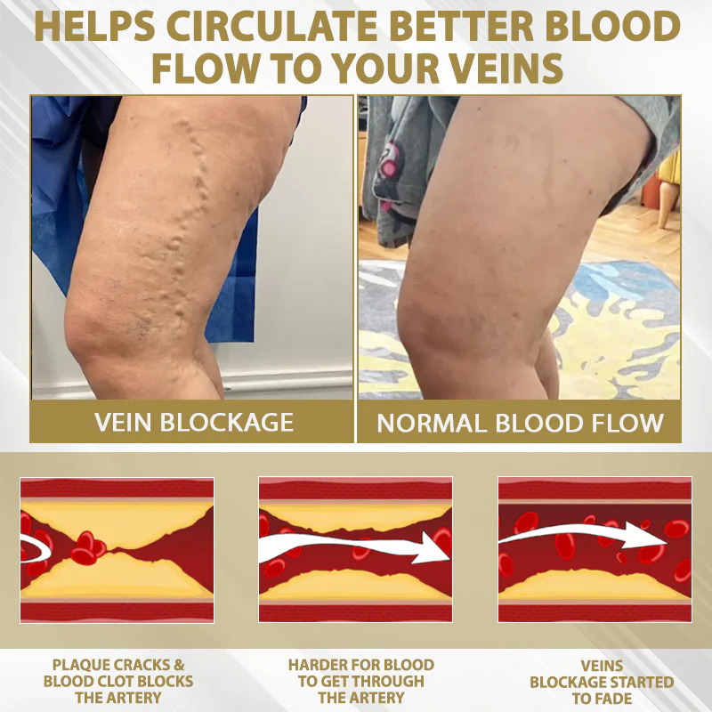 ATTDX® CortiEase Hormonal Swelling Balance Cream 6 ATTDX® CortiEase Hormonal Swelling Balance Cream - Image 6