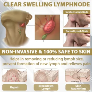 ATTDX® CortiEase Hormonal Swelling Balance Cream 16 ATTDX® CortiEase Hormonal Swelling Balance Cream