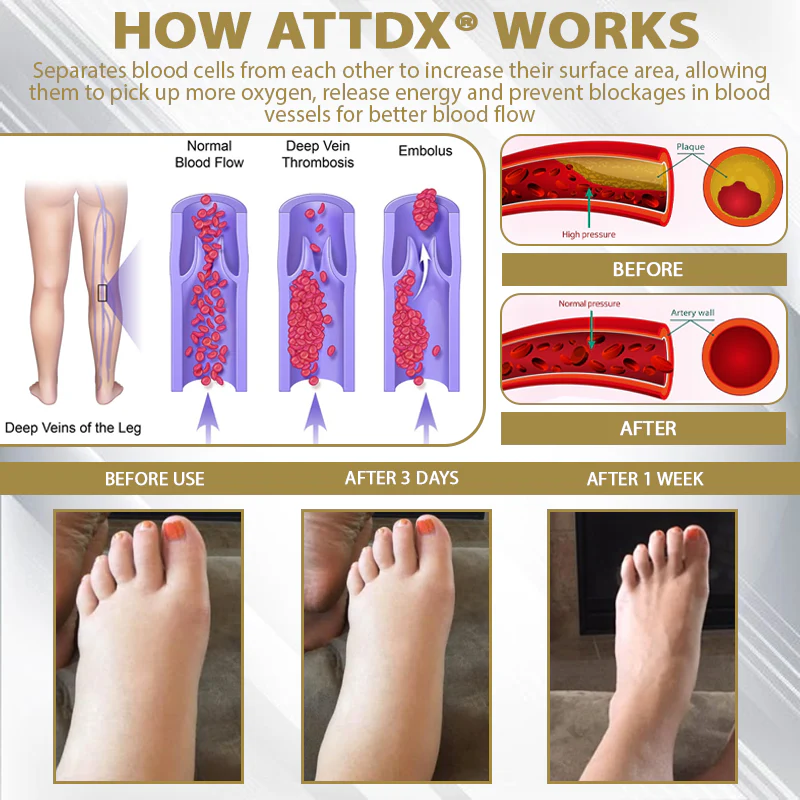 ATTDX® CortiEase Hormonal Swelling Balance Cream 5 ATTDX® CortiEase Hormonal Swelling Balance Cream - Image 5