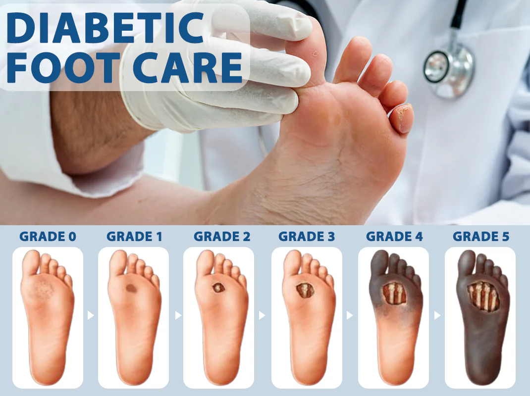 ATTDX® Diabetes Foot Guard Fast Recovery Spray 8 ATTDX® Diabetes Foot Guard Fast Recovery Spray - Image 8