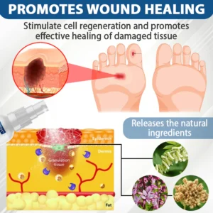 ATTDX® Diabetes Foot Guard Fast Recovery Spray 17 ATTDX® Diabetes Foot Guard Fast Recovery Spray