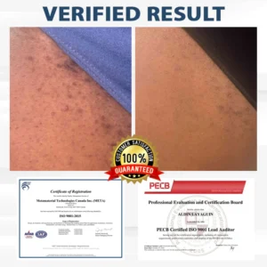 Fivfivgo® LicorRelief Man Genital Antifungal Cream