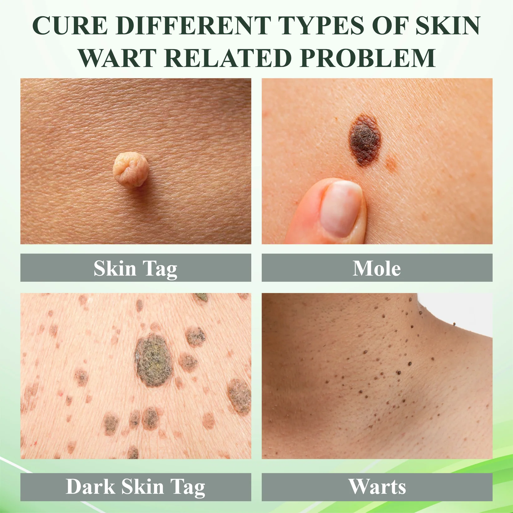 ATTDX® Reedle Shot 100 Tag & Spot Target Advanced Serum 10 ATTDX® Reedle Shot 100 Tag & Spot Target Advanced Serum - Image 10