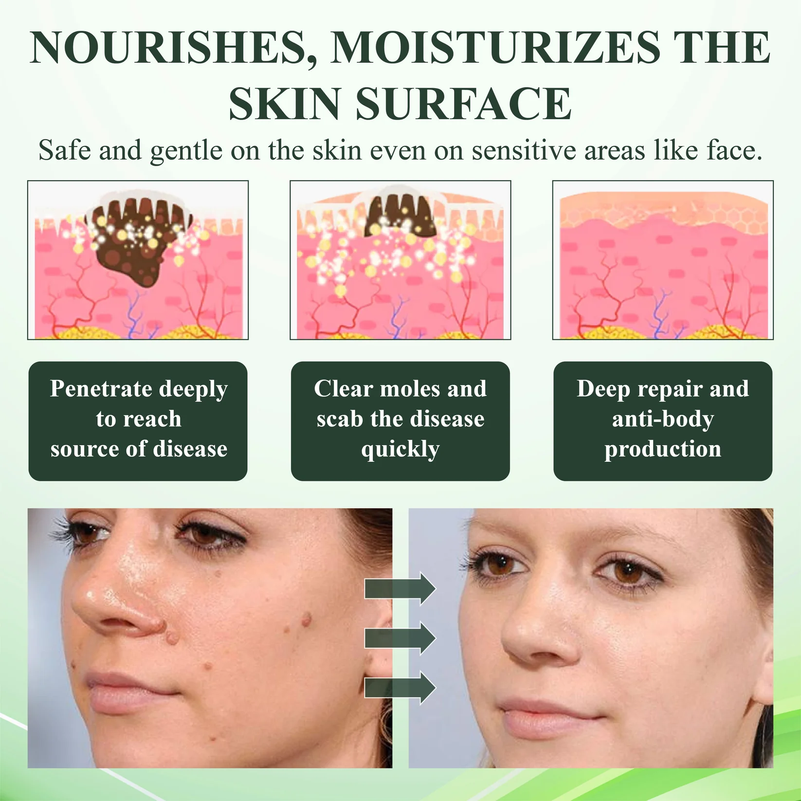 ATTDX® Reedle Shot 100 Tag & Spot Target Advanced Serum 6 ATTDX® Reedle Shot 100 Tag & Spot Target Advanced Serum - Image 6