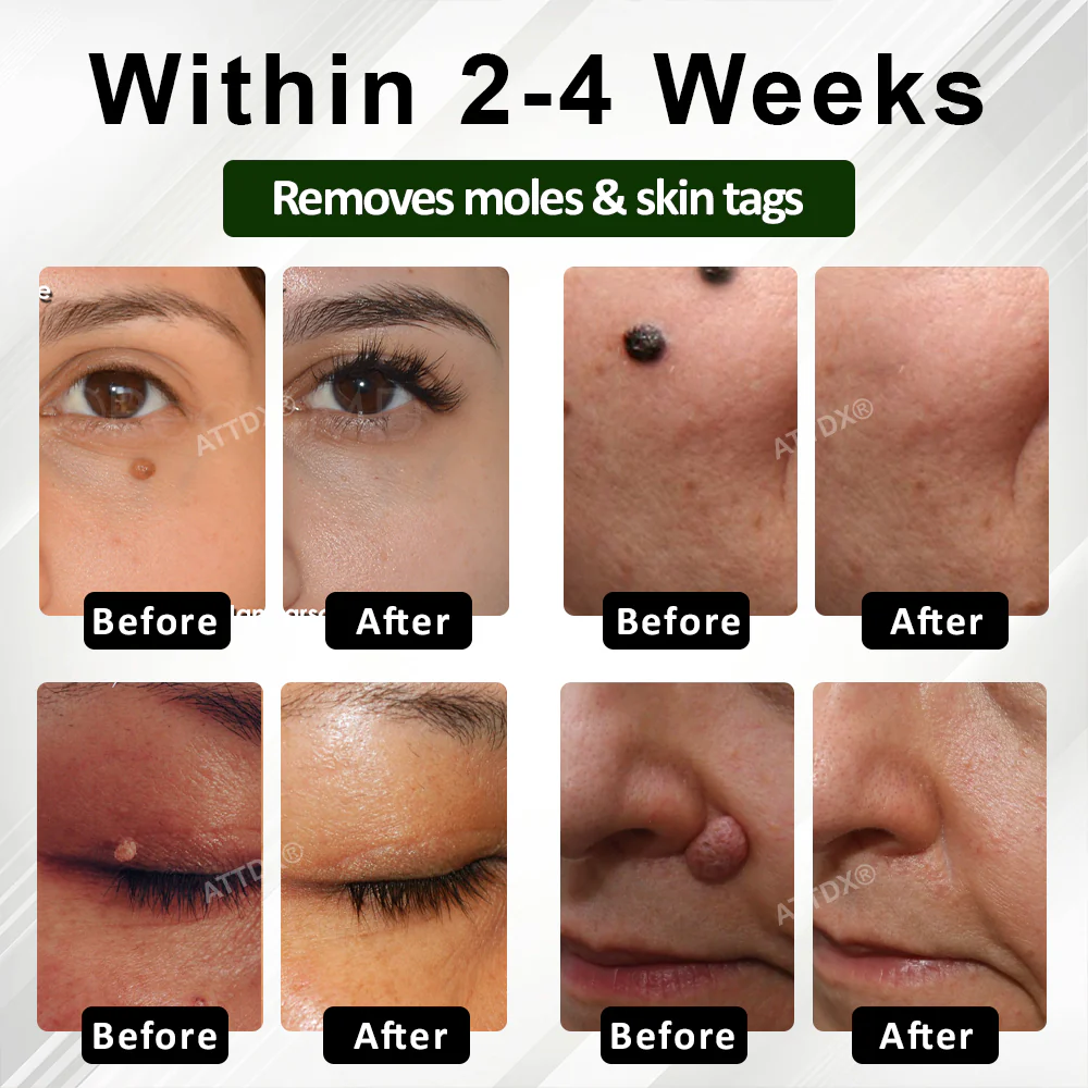 ATTDX® Reedle Shot 100 Tag & Spot Target Advanced Serum 3 ATTDX® Reedle Shot 100 Tag & Spot Target Advanced Serum