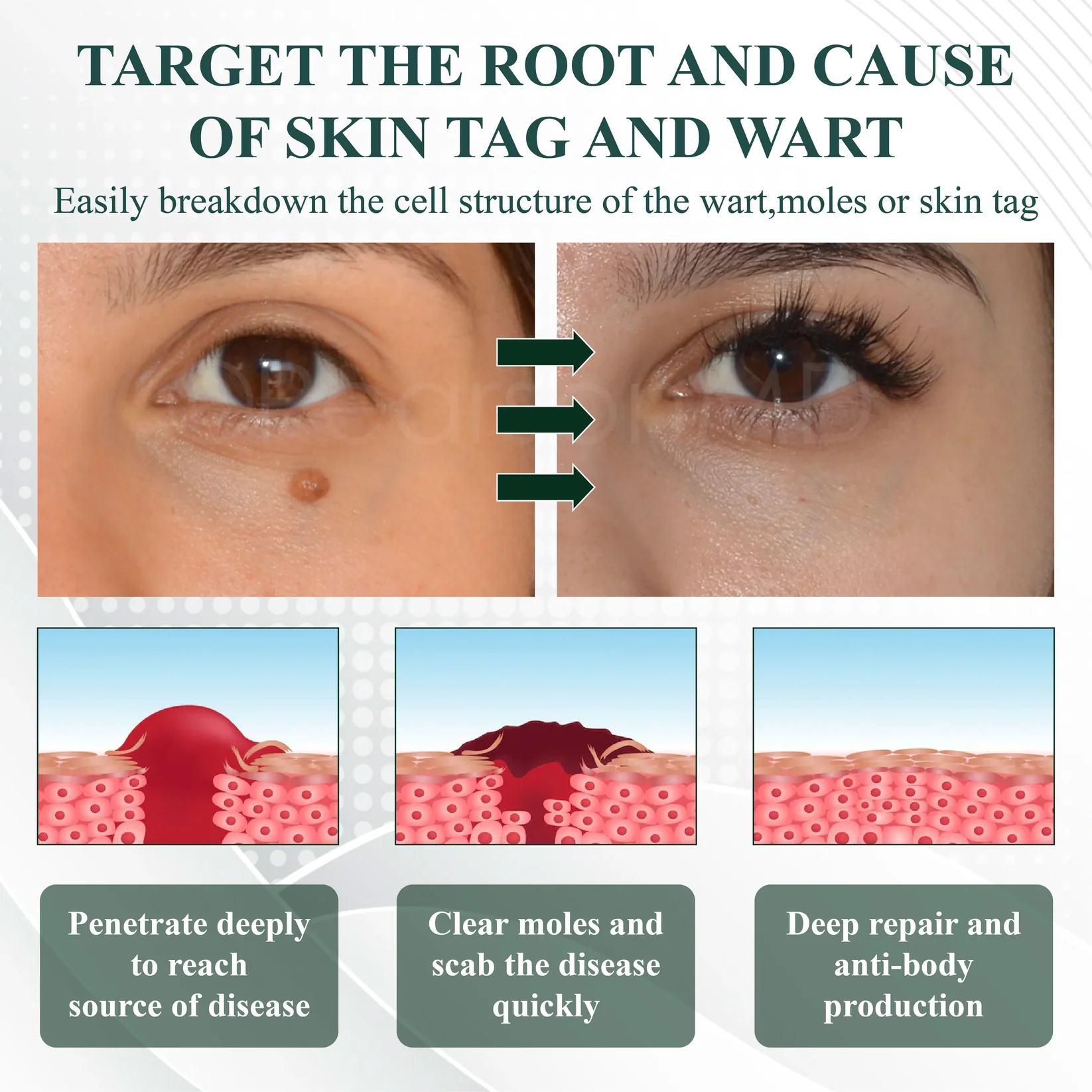 ATTDX® Reedle Shot 100 Tag & Spot Target Advanced Serum 7 ATTDX® Reedle Shot 100 Tag & Spot Target Advanced Serum - Image 7