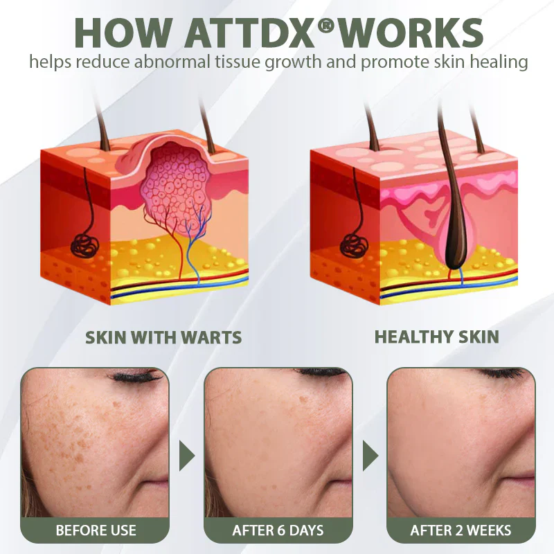 ATTDX® Reedle Shot 100 Tag & Spot Target Advanced Serum 8 ATTDX® Reedle Shot 100 Tag & Spot Target Advanced Serum - Image 8