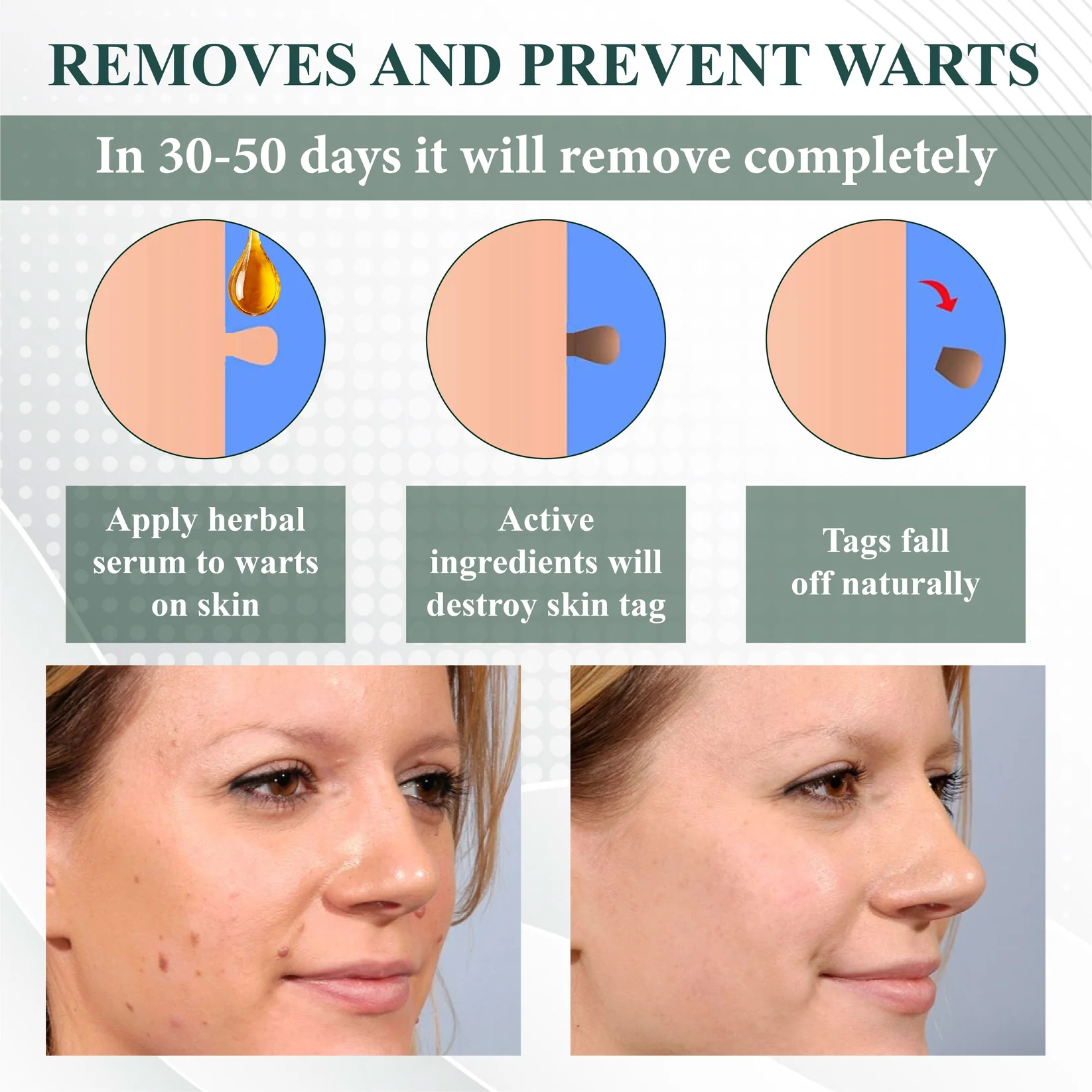 ATTDX® Reedle Shot 100 Tag & Spot Target Advanced Serum 9 ATTDX® Reedle Shot 100 Tag & Spot Target Advanced Serum - Image 9