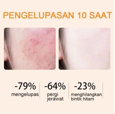 BBOJI™ Orange Enzyme Exfoliating Gel 5 BBOJI™ Orange Enzyme Exfoliating Gel - Image 5